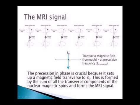 A level Medical physics - MRI part 1, the physics behind MRI - YouTube