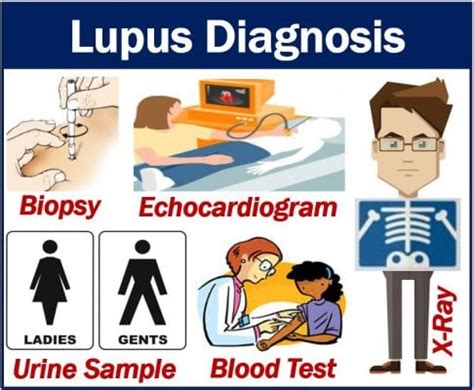 Lupus diagnosis and different types of tests doctors order - MBN Health