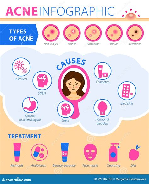 What Causes Acne Outbreaks at Eric Jones blog