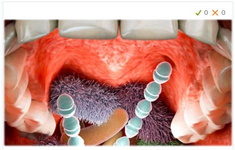 Germ quiz for your mouth | Port Pediatric Dentistry