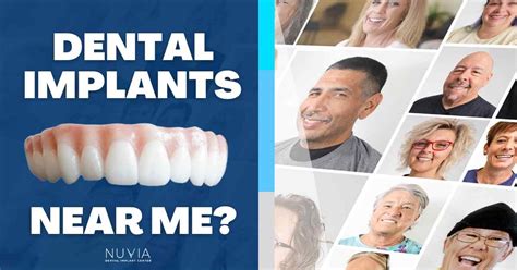 Nuvia Dental Implants Near Me