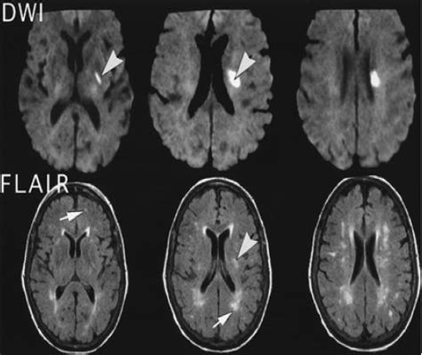 Chụp cộng hưởng từ MRI sọ não - Thuốc Thảo Mộc