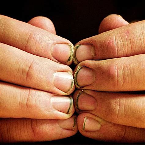 dirty finger nails =nasty | Stuff/People I dislike/hate/weird, gross/dumb stuff | Pinterest ...