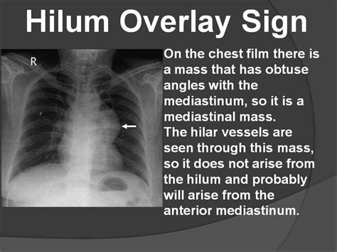 Radiology Student, Radiology Imaging, Medical Radiography, Np School ...