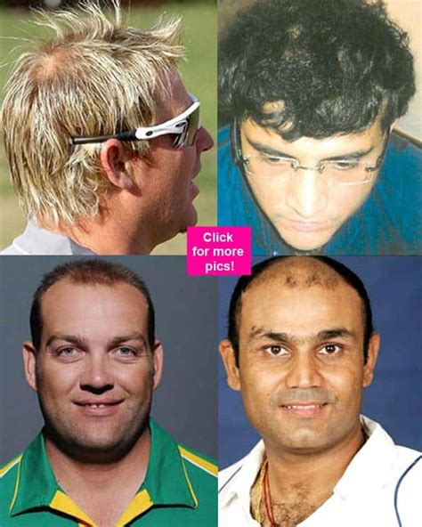 Sourav Ganguly, Jacques Kallis, Virender Sehwag, Doug Bollinger- 10 cricketers who went for hair ...