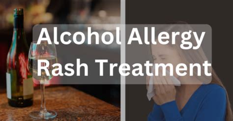 Alcohol Allergy Rash Treatment Complete Guide | United Recovery ...