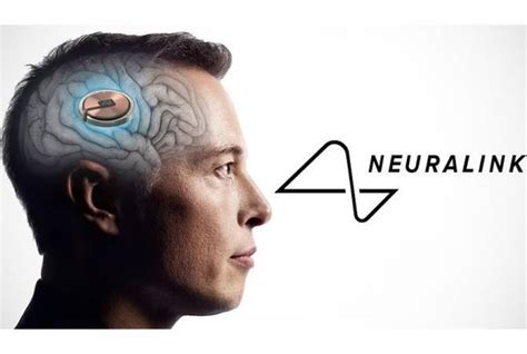 La 1ère puce Neuralink d'Elon Musk a été implantée dans un cerveau humain