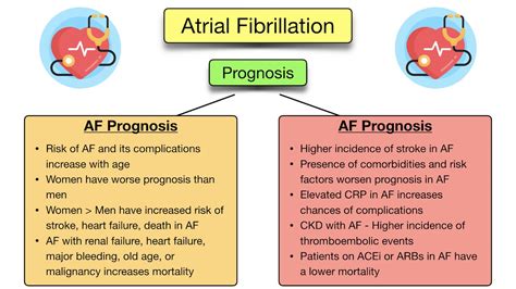 Atrial Fibrillation: Symptoms, ECG, Causes, Treatment, Definition ...