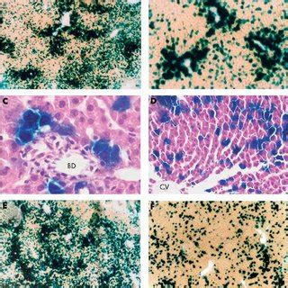 LacZ gene expression in rat livers induced by intrabiliary or... | Download Scientific Diagram