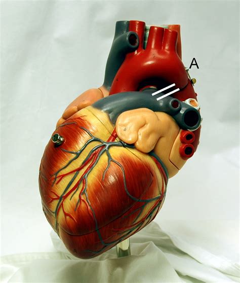File:Heart frontally PDA.jpg - Wikimedia Commons