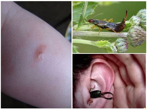 Earwigs - photos and descriptions of the insect, whether dangerous to ...