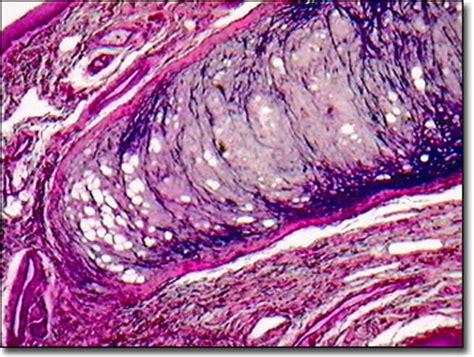 Molecular Expressions: Science, Optics & You - Olympus MIC-D: Brightfield Gallery - Epiglottis ...