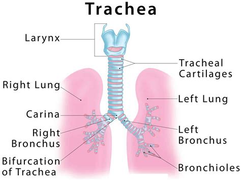 Tracheomalacia Tracheostomy