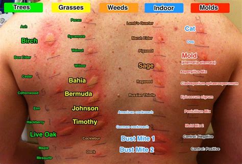 Pin by Bette on Health tips | Dust mite allergy, Dust allergy, Allergy remedies