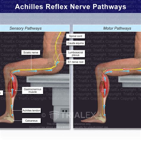 Achilles Reflex Nerve Pathways - Trial Exhibits Inc.