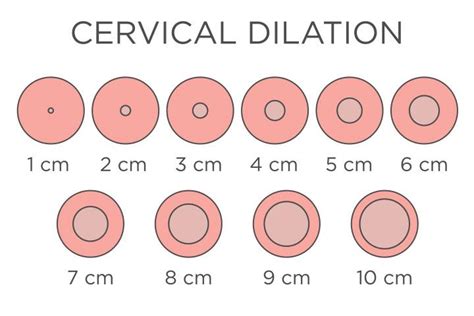 Cervix Dilation Chart: Signs, Stages And Procedure To Check