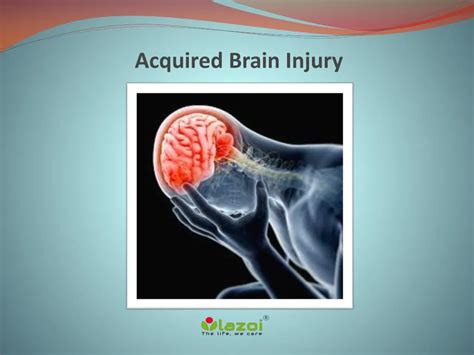 PPT - Acquired Brain Injury Causes, Symptoms, Diagnosis, Risk factor, Prevention Treatment in ...