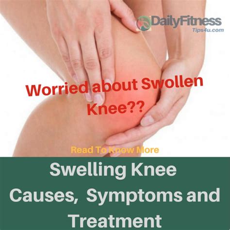 Swelling Knee : Causes, Pictures, Symptoms And Treatment