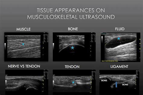 Musculoskeletal Ultrasound - Where do I begin? - Gulfcoast Ultrasound ...