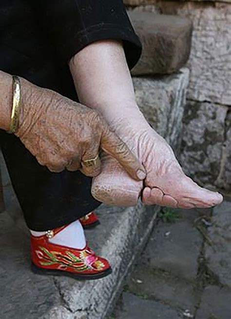 The Last Woman To Follow China's 1000-Year-Old Foot-Binding Tradition Shows The Damage Done ...