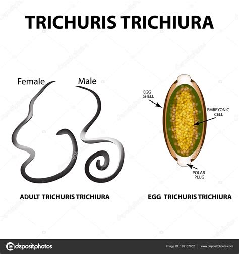 Trichuris trichiura structure of an adult. The structure of the egg Trichuris trichiura. Set ...