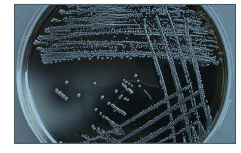 Bacteroides fragilis | Ask Microbiology