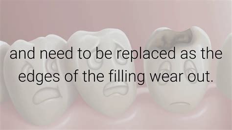 Dental Filling Replacement Procedure - Dental Clinic