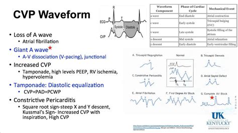 20160122 High Yield Cardiac Keywords Part 2 - YouTube