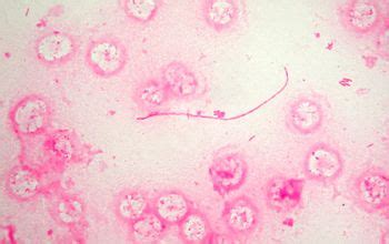 Legionella pneumophila