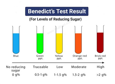 Benedict’s Test: Objectives, Principle, Procedure, Results, Limitations ...