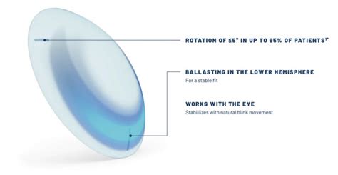 Multifocal Contact Lens Designs: Know the Players