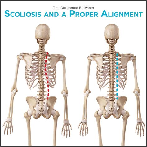 Pin on Back Injuries & Spine Disorders | What's Causing my Back Pain? Lower, Middle, & Upper ...