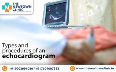 Types and Procedures of an Echocardiogram - The Newtown Clinic