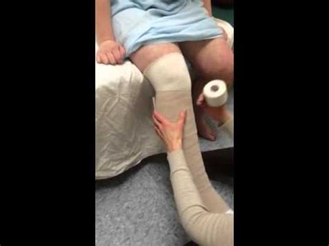 Lymphedema leg wraps - YouTube