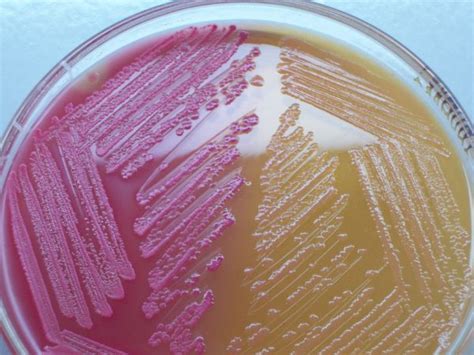 Escherichia coli O157: H7 - Food Safety Certification