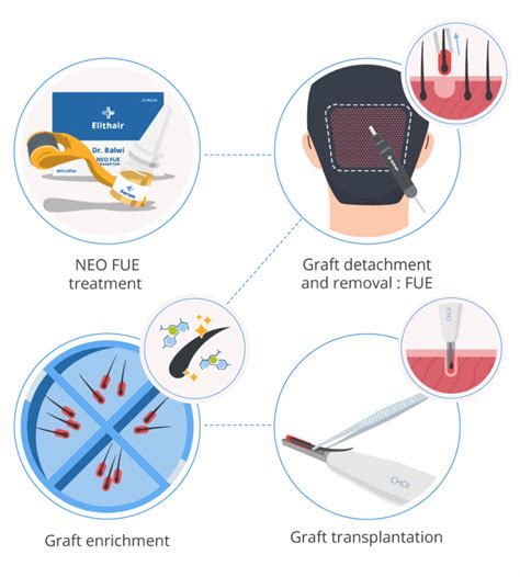 Achieve Natural Hair Restoration with DHI Transplant | Elithair