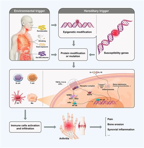 Principle of the development of arthritis. Hereditary and environmental ...