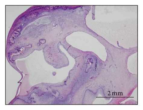 Histology of teratoma generated by Edom-iPS#S23 cells. (a) Teratoma ...