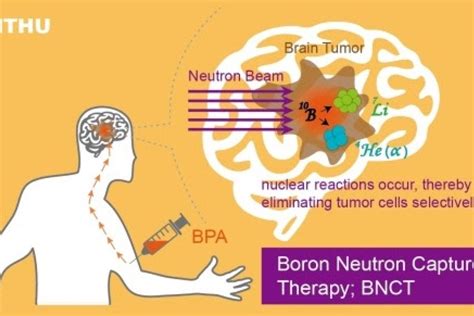 NTHU’s Boron Neutron Capture Therapy Center begins treating overseas ...