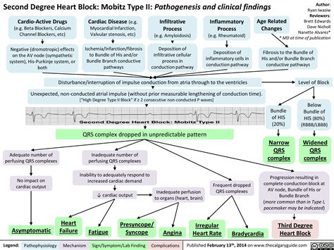 Second Degree Heart Block: Mobitz Type II: Pathogenesis and clinical findings | Calgary Guide