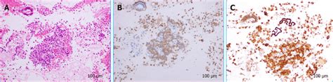 Hematoxylin and eosin staining and immunostaining. A: Hematoxylin and... | Download Scientific ...