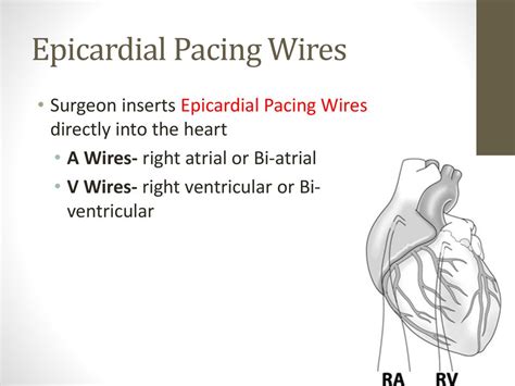 EKGs and Pacemakers Cooper University Hospital - ppt download