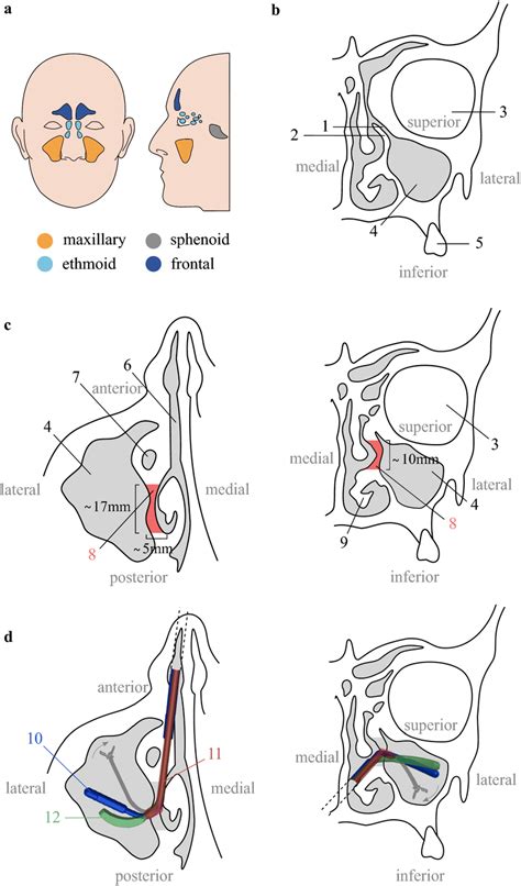 Maxillary sinus anatomy. (a),Location of the paranasal sinuses (Adapted ...