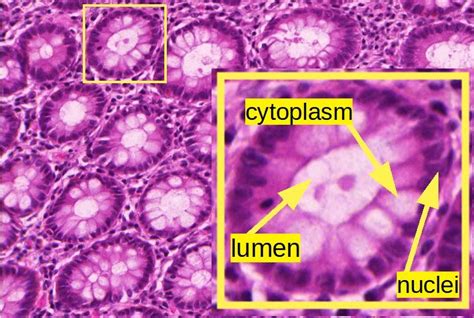 A histological image of colon mucous glands. | Download Scientific Diagram