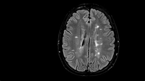 Biomedical Imaging - Microsoft Research