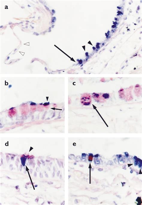 Figure 1 from Number and proliferation of clara cells in normal human airway epithelium ...