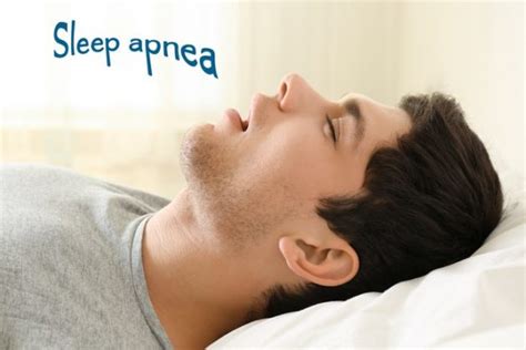 Sleep Apnea (Overview , Symptoms , Causes , Risk Factors , Types ...