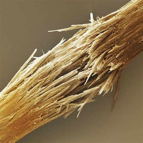 Damaged Human Hair Shaft Sem Photograph by Science Photo Library