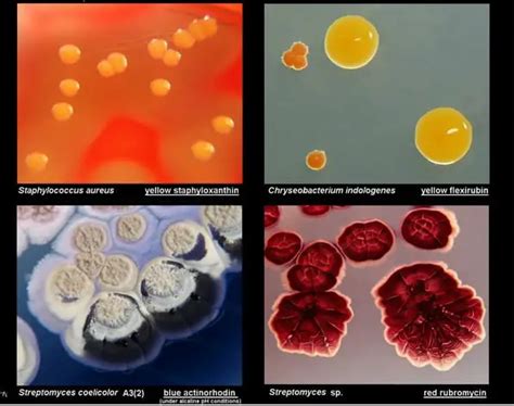 types of bacteria colonies