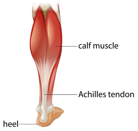 Tendinopathies: What You Need to Know